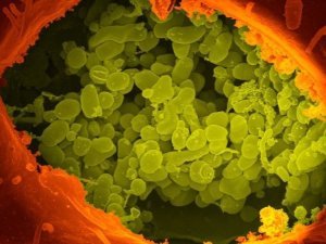 Q © National Institutes of Health (NIH)